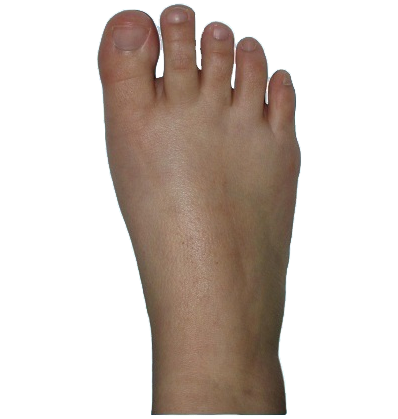 Barefoot PNG