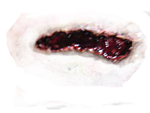 wound PNG image