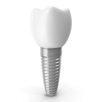 Dental implant PNG