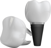 Dental implant PNG