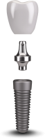 Dental implant PNG