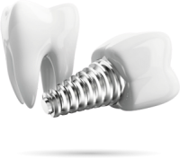 Dental implant PNG