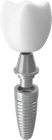 Dental implant PNG