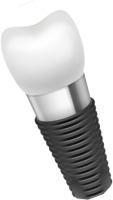 Dental implant PNG
