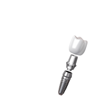 Dental implant PNG