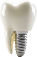 Dental implant PNG