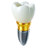 Dental implant PNG