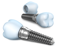 Dental implant PNG