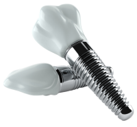 Dental implant PNG