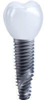 Dental implant PNG