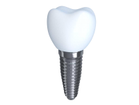 Dental implant PNG