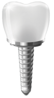 Dental implant PNG