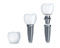 Dental implant PNG