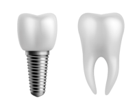 Dental implant PNG