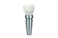 Dental implant PNG image