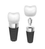 Dental implant PNG