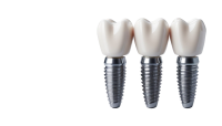 Dental implant PNG