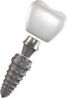 Dental implant PNG