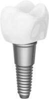 Dental implant PNG