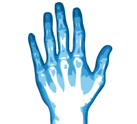 X-rays PNG