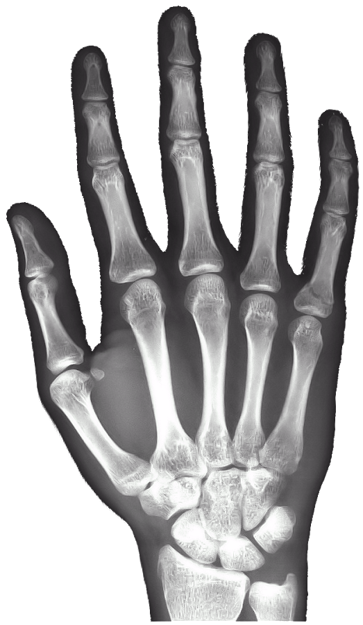 X-rays PNG