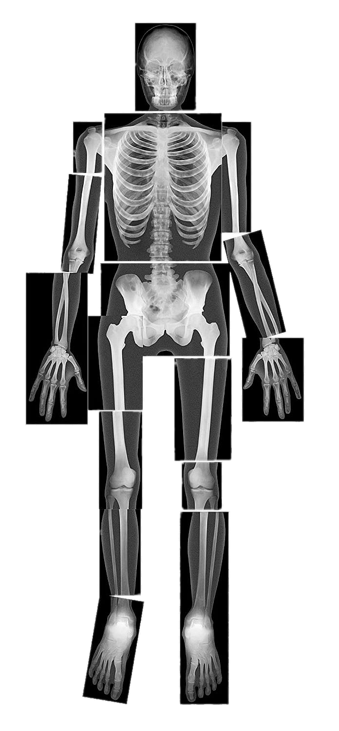Radiograf a PNG